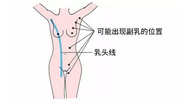 两条线内衣_验孕棒图片两条线图片(2)