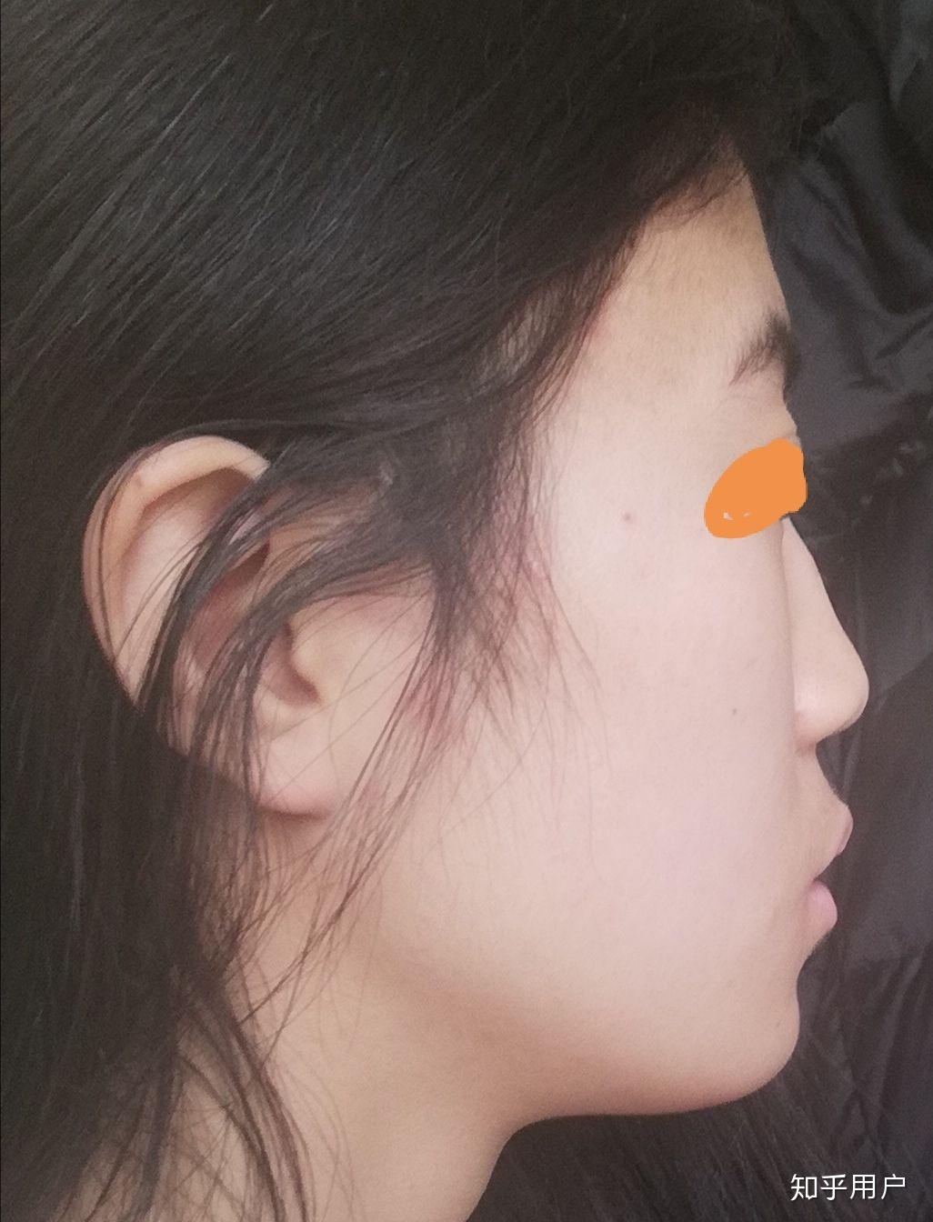 有一个超级扁平的侧脸是一种什么样的体验