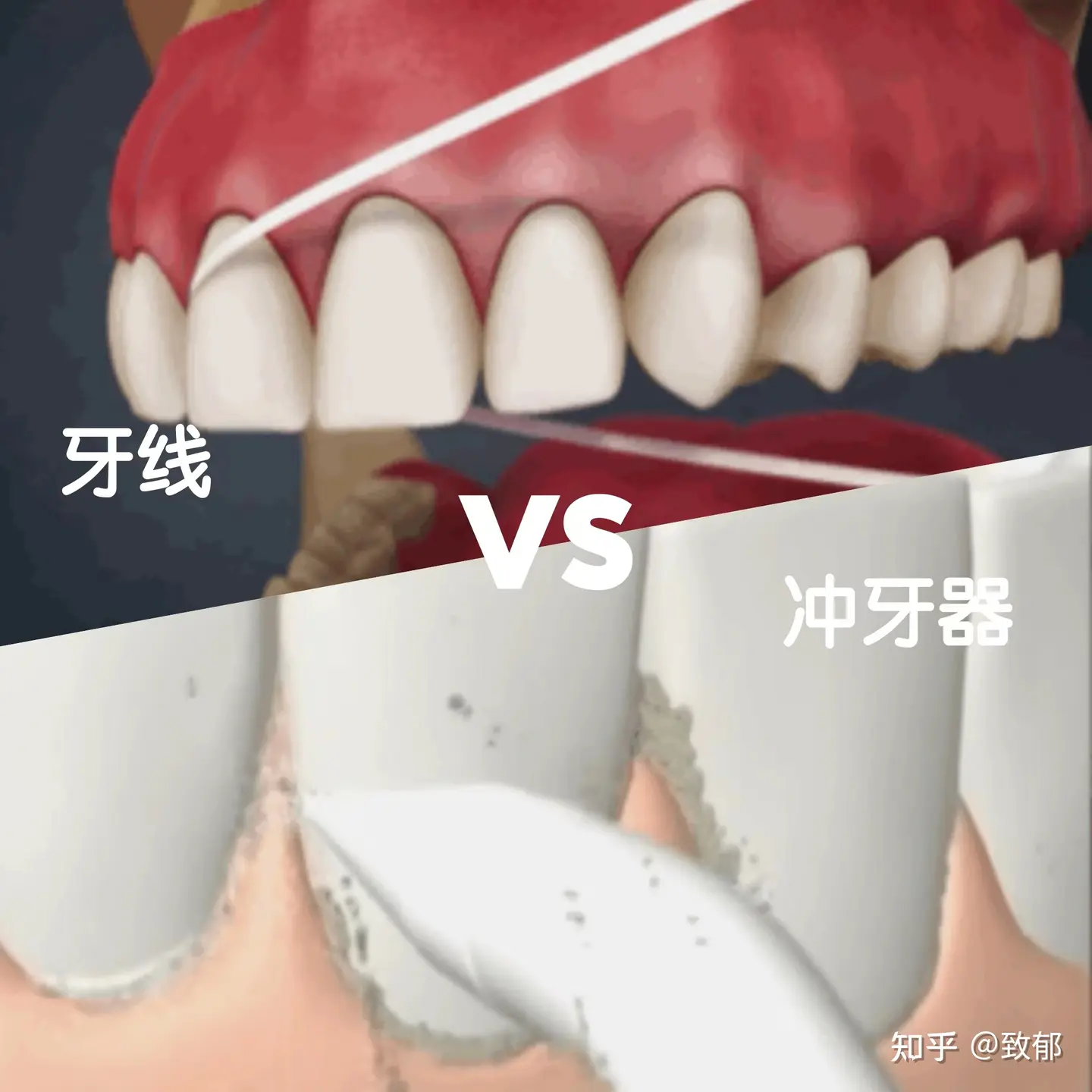 冲牙器和牙线有什么区别?五百以内能买到好用的冲牙器吗?
