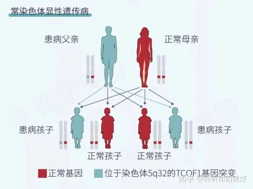 鸟面综合症原因是什么图片