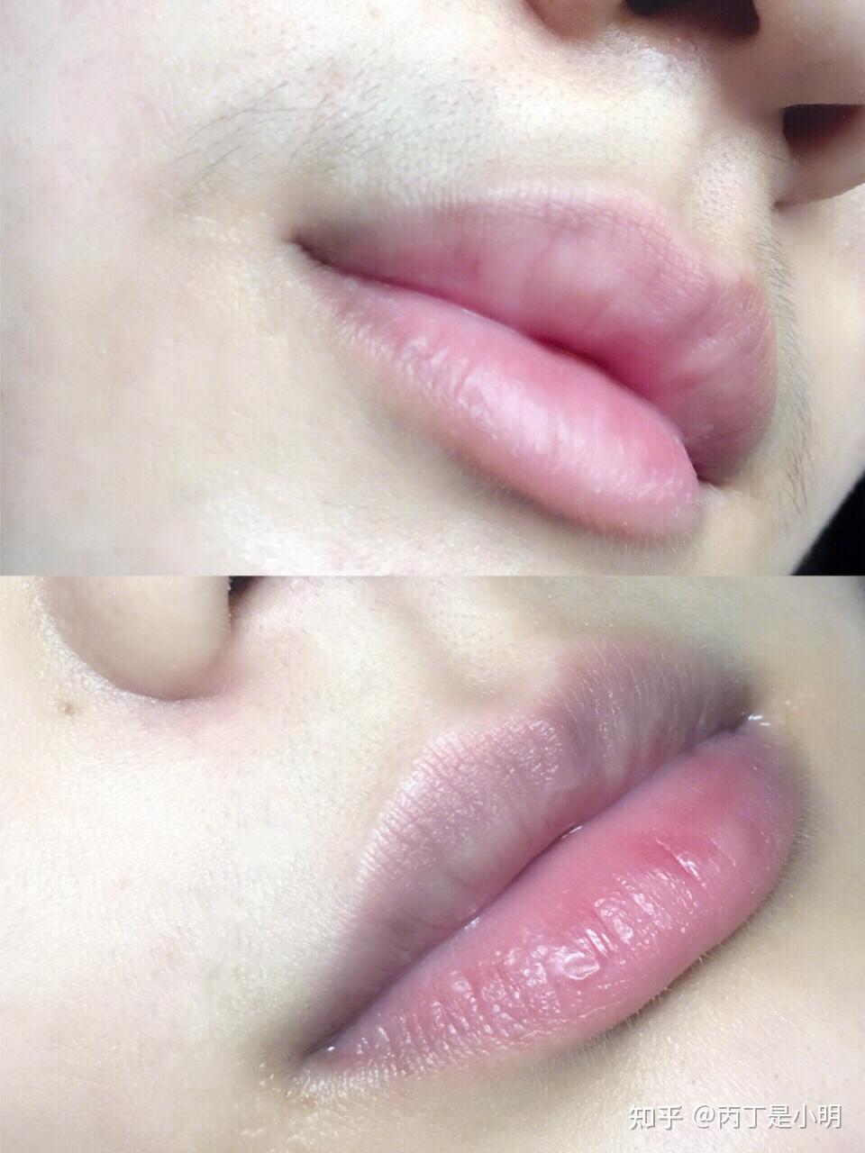 我可以用来脱脖颈后的毛毛还可以用来脱脸上的小胡子那些不敢用脱毛