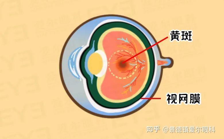 一张方格表，可测眼底黄斑健康？ - 知乎