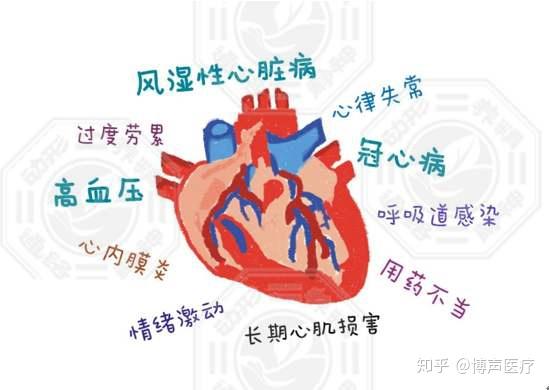 博声医疗:心力衰竭,慢性心力衰竭