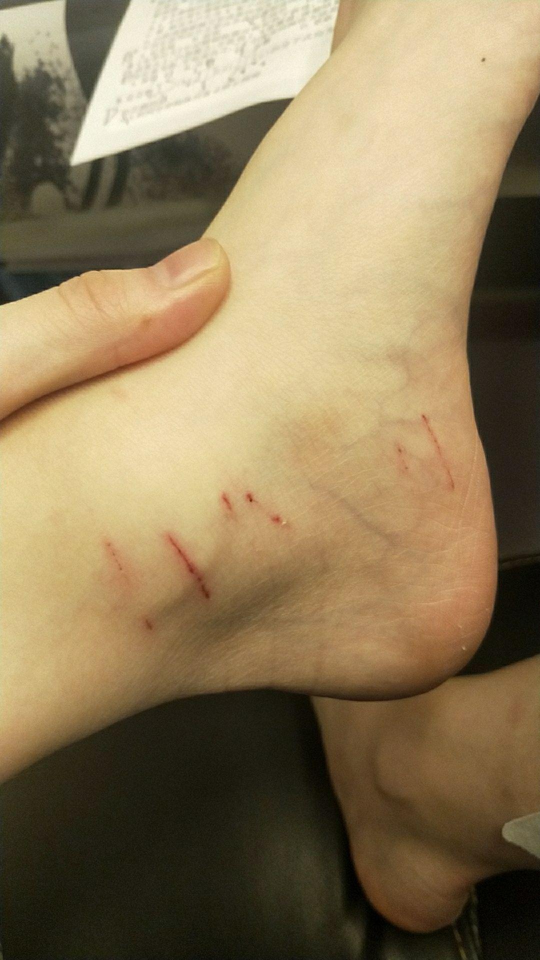 被家猫抓出血怎么办啊