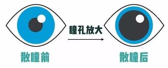 散瞳对正确验光配镜非常重要！ - 知乎