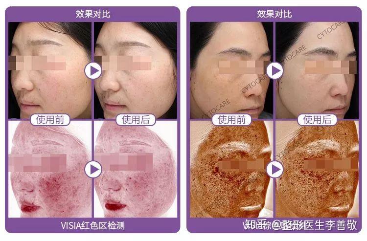 抗氧化的赋能之选—cytocare丝丽动能素