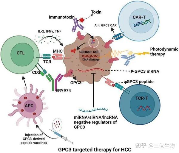 三优药讯｜GPC3 CAR-T细胞联合索拉非尼，肿瘤病灶完全消失 - 知乎