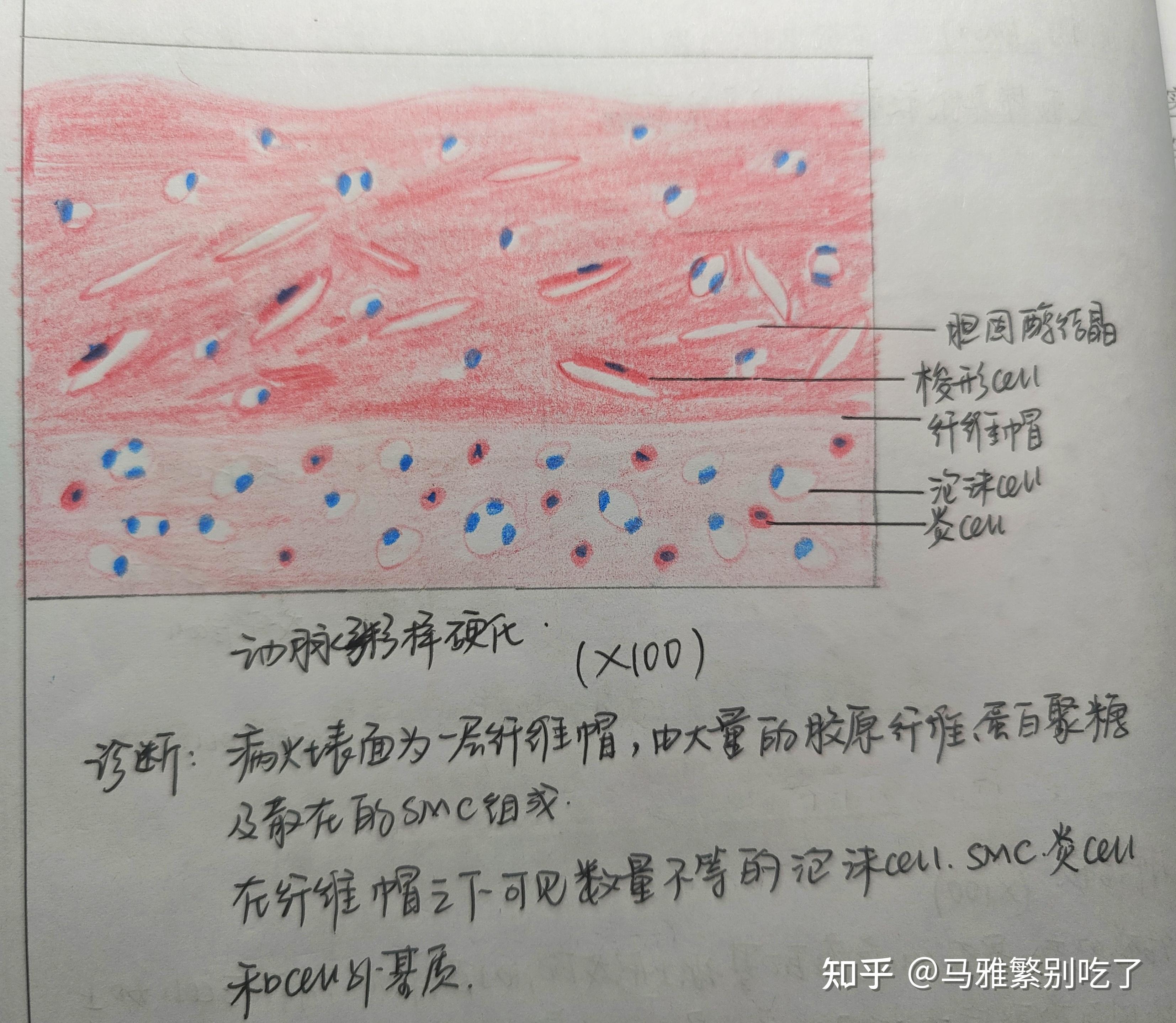 平滑肌红蓝铅笔怎么画图片