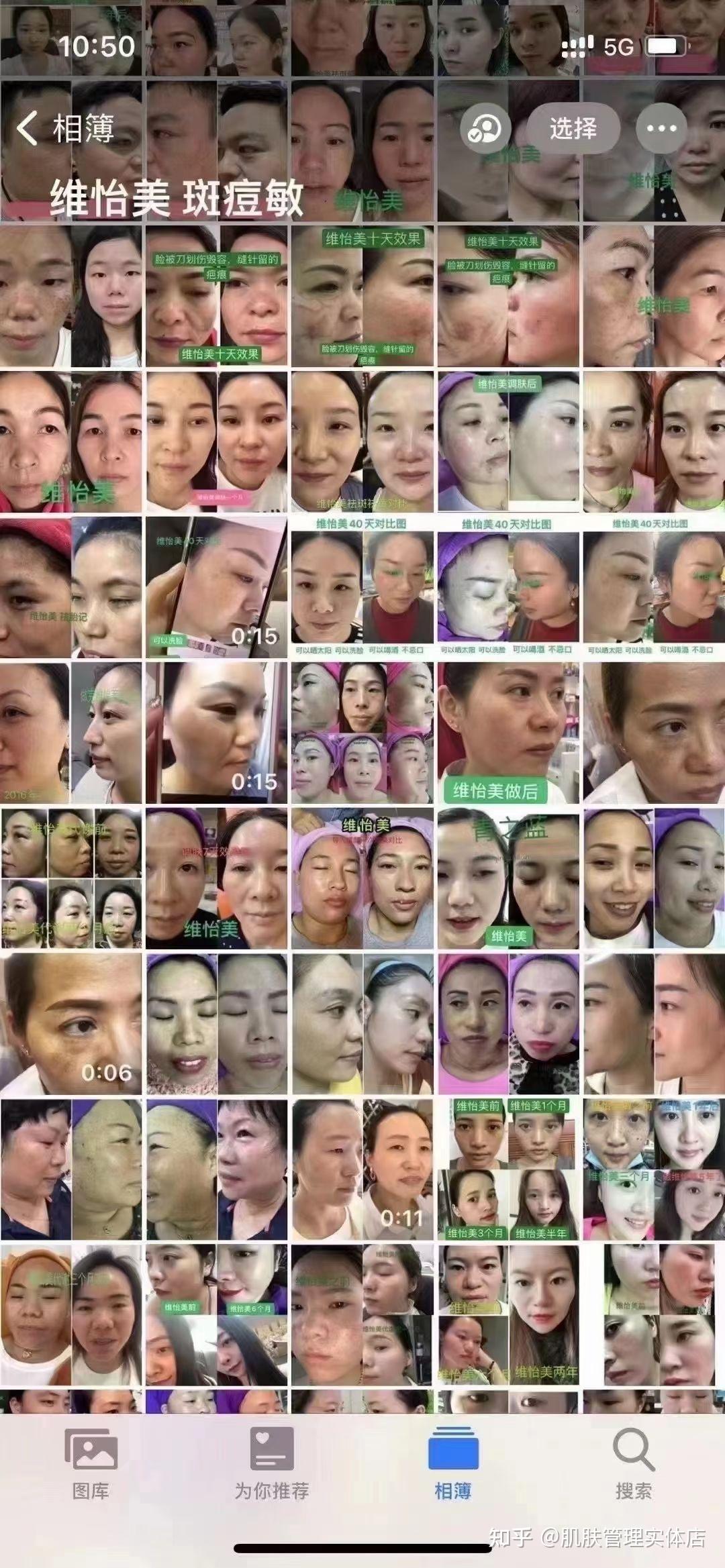 维怡美可以祛斑?