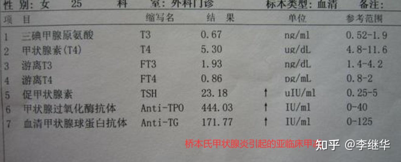 甲减降不下去怎么做试管(甲减试管移植的话有影响吗)-第1张图片-鲸幼网