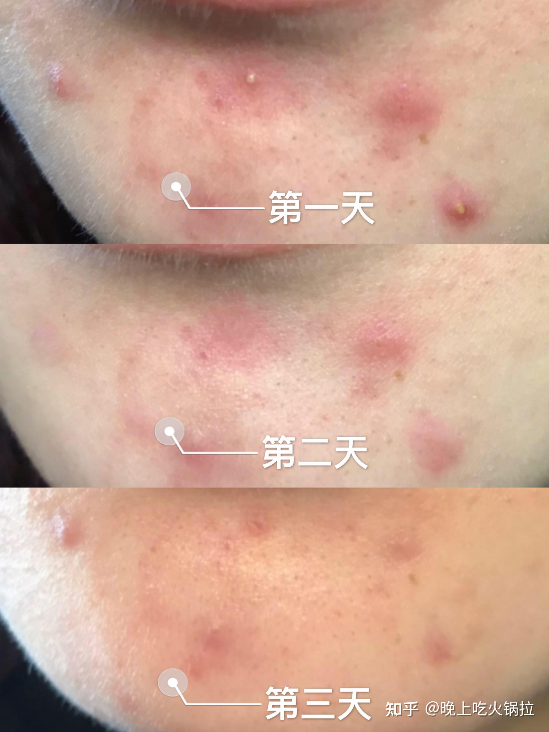 身体湿气重如何调理