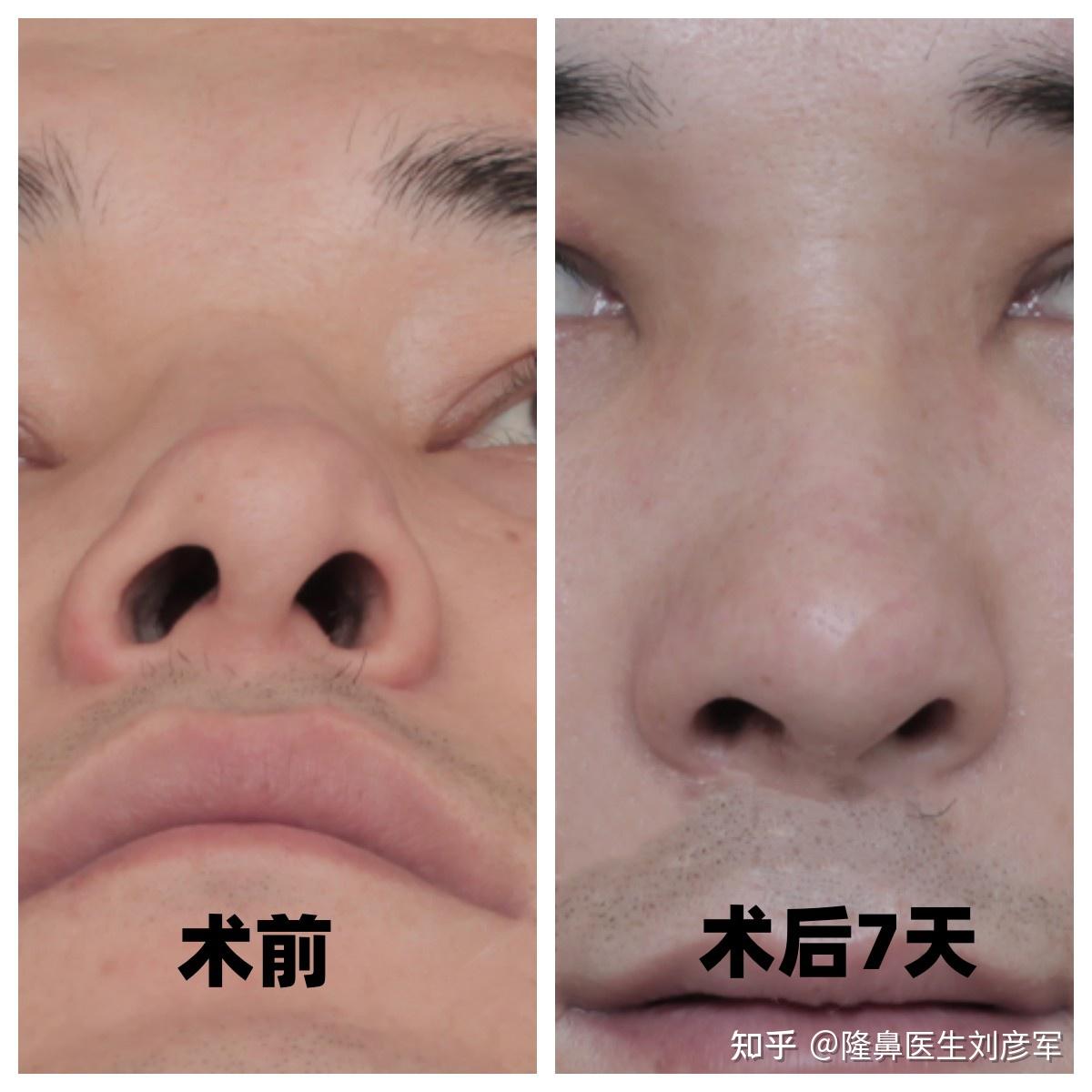 图1-76 外鼻和鼻中隔-基础医学-医学