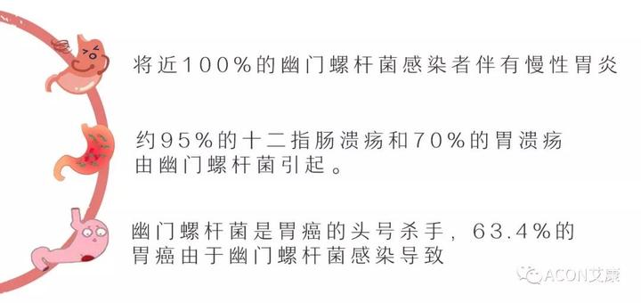 有这几种症状 你可能已感染了幽门螺杆菌 知乎