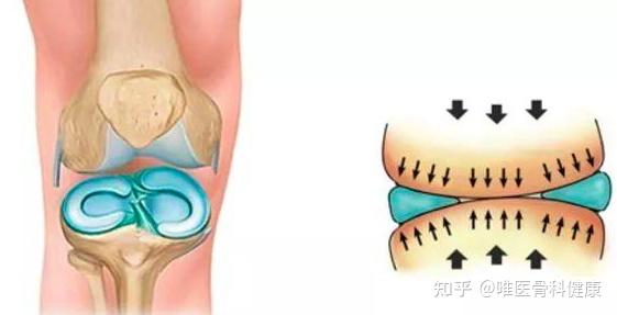 半月板成對存在,內外側各一個,內側半月板呈