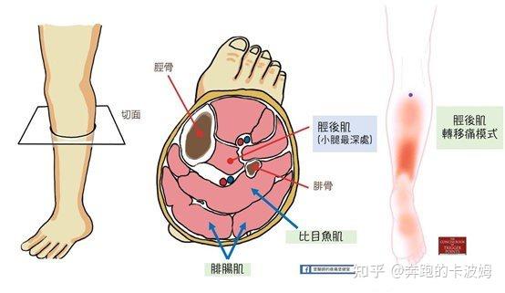 小腿肌第一层 腓肠肌