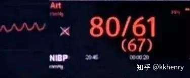 放轻松,深呼吸,我们开始麻醉了