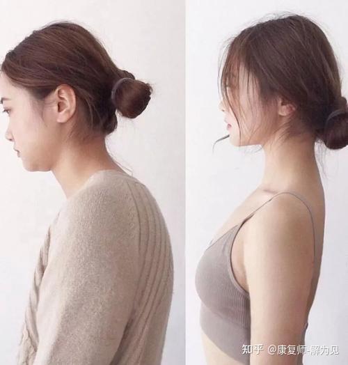 含胸驼背头前伸的不良体态,甚至会导致自己在做一些挺胸抬头的动作时