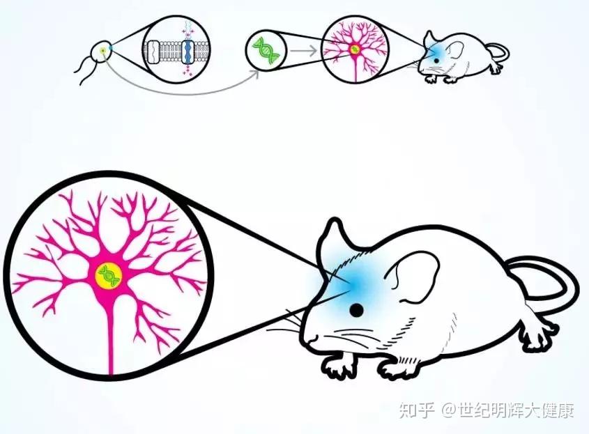 干细胞将会成为老年痴呆症患者的希望之光