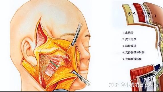 and after the ear, less trauma, faster recovery, generally