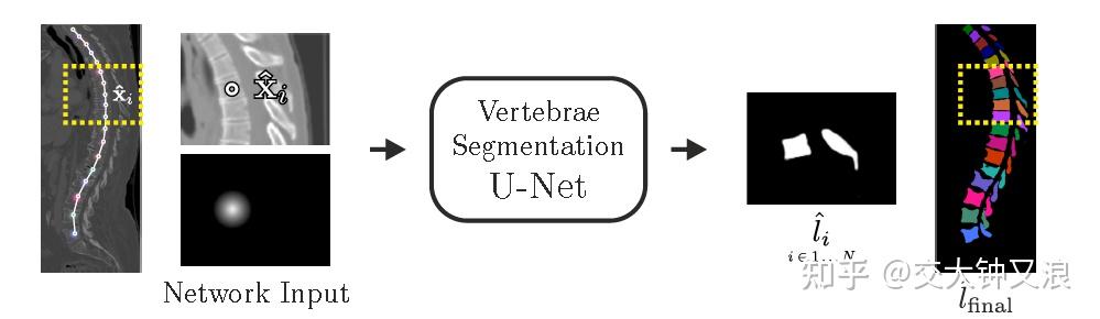 Coarse to Fine Vertebrae Localization and Segmentation with ...