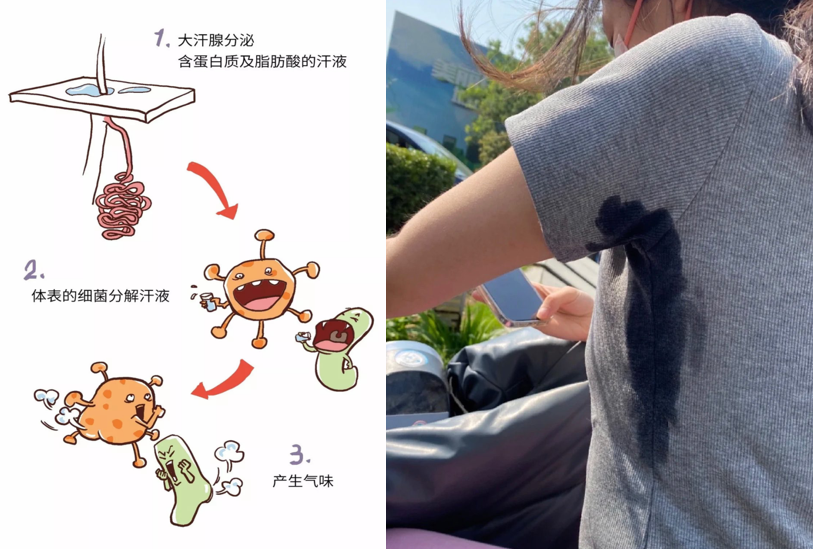 【狐臭请进】身上有狐臭改怎么办？狐臭怎么除？皮肤科医生强烈建议你，当身上狐臭、异味过重时，只有正确抑菌才能解决！教你3步止臭法，科学不伤身能给 ...