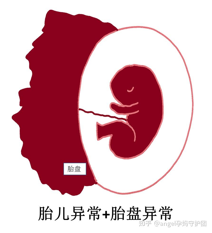 v2-4fb7bfbe0e9f09314a6cdeefd574ae69_r.jpg