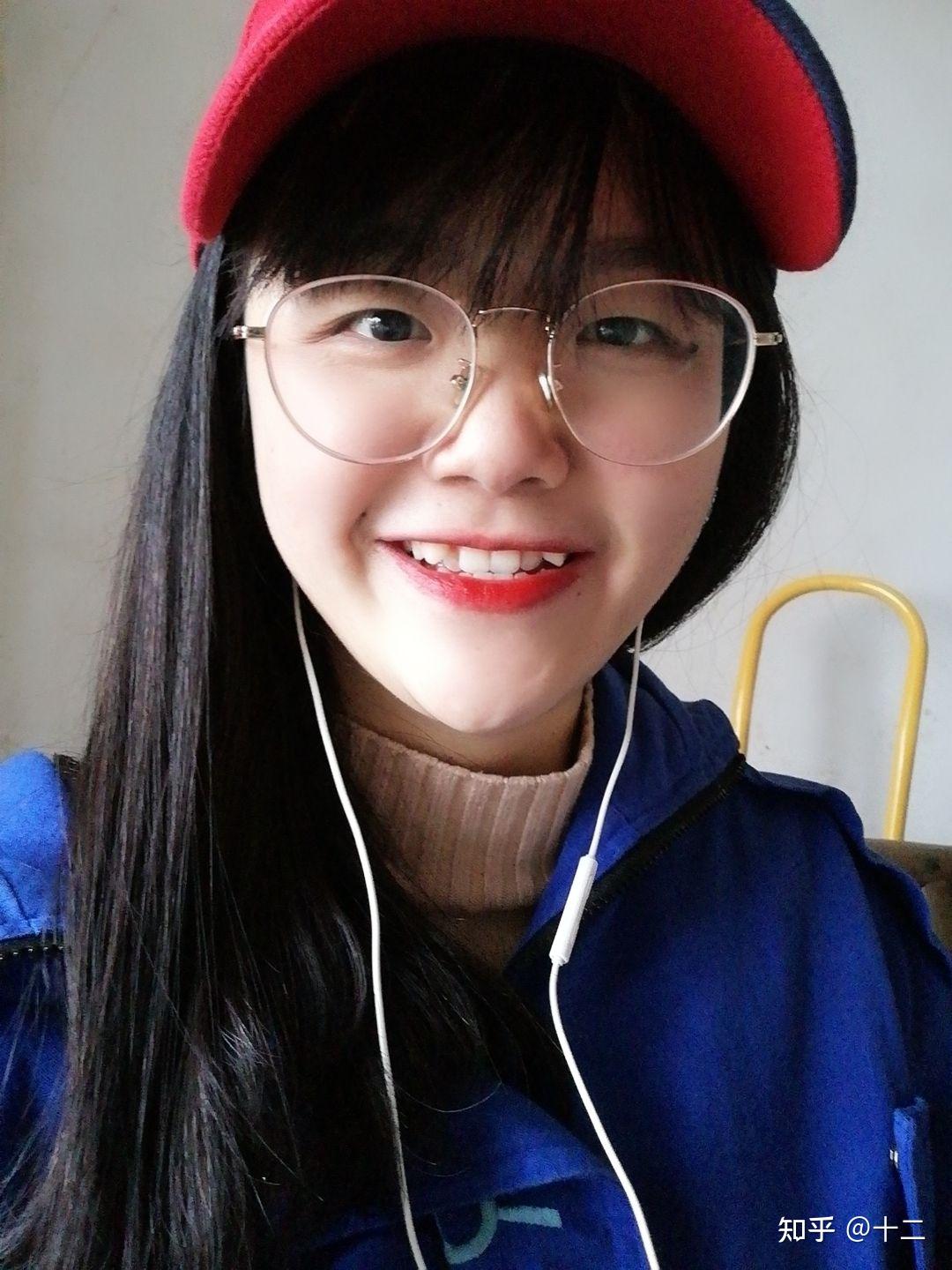 虎牙拥挤,牙列不齐,带轻微反颌,也许不能算轻微哈哈哈哈,大家看照片就
