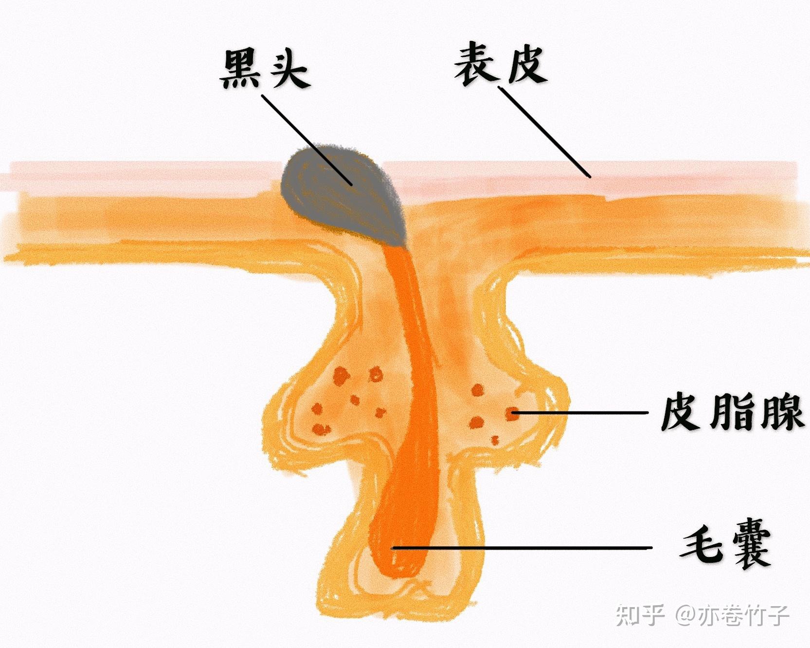 男士如何去黑头?4年实战硬核攻略