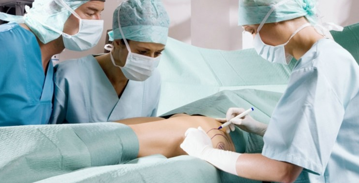 抽脂手术的恐怖超过你的想象|身体减肥