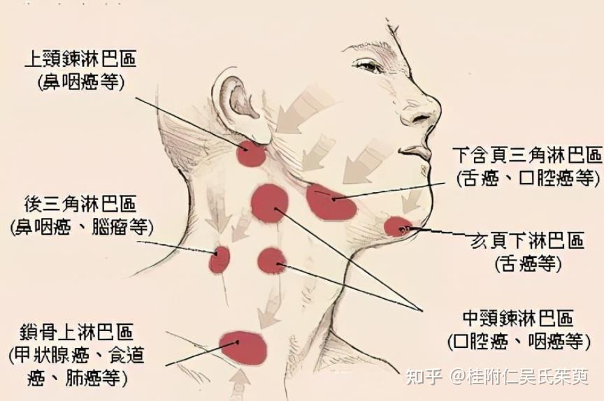 下颚扁桃体位置图片图片