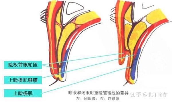 你知道吗？根据睑板设计双眼皮宽度最自然 - 知乎