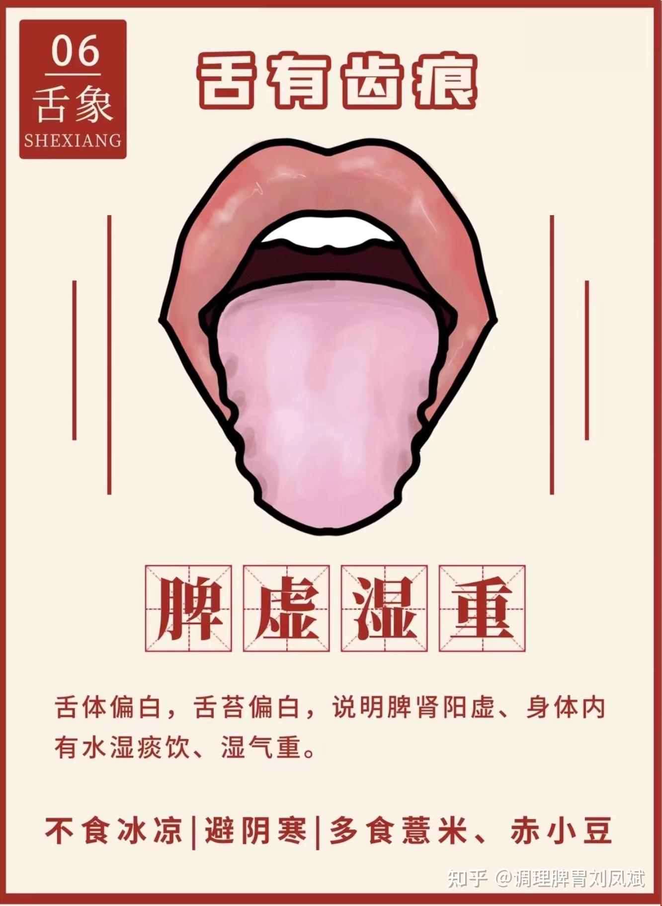 中医教你看舌苔 - 知乎