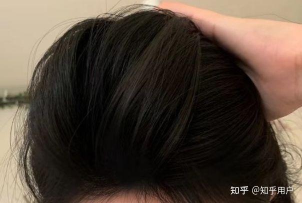 发量暴增秘诀来了!过来人亲测有效的养发秘籍大曝光,实现发量富翁就靠它!! - 知乎