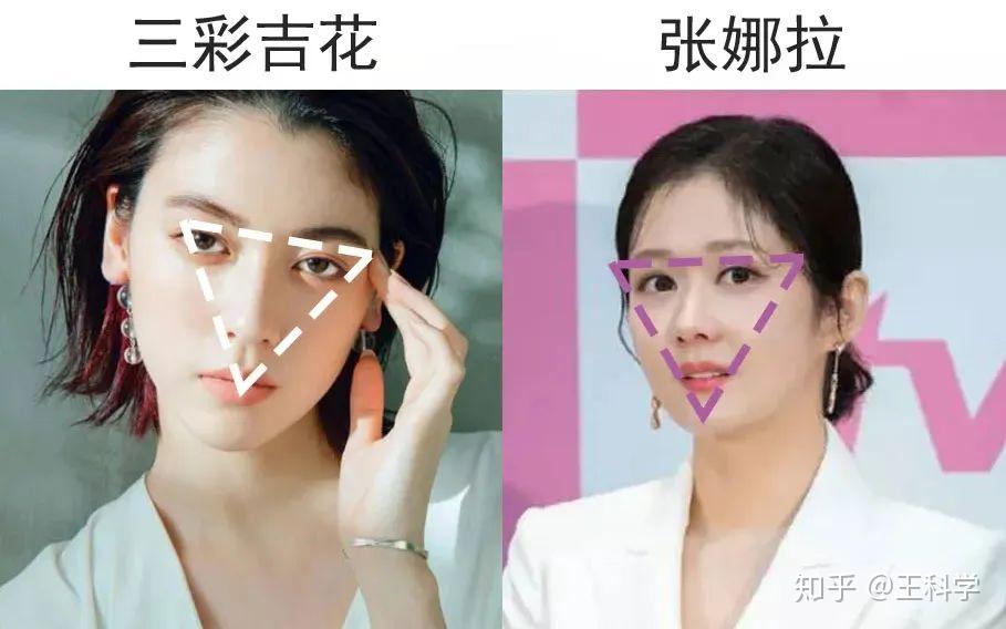 各大女明星都在做的自体脂肪填充你们千万别做