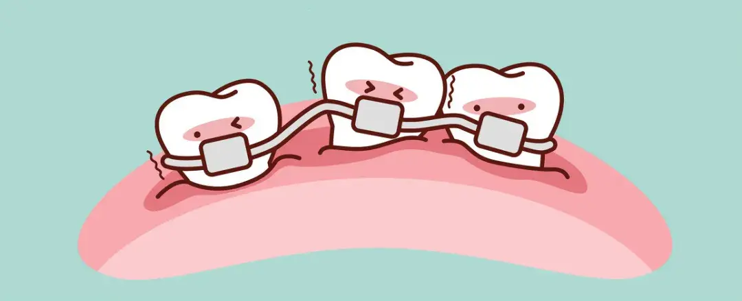 有种植牙还能做牙齿矫正吗
