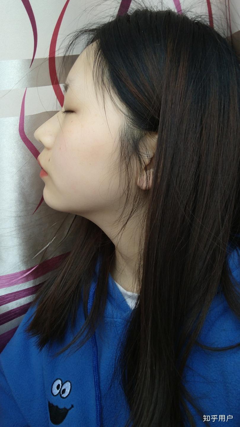 没有山根是种什么体验