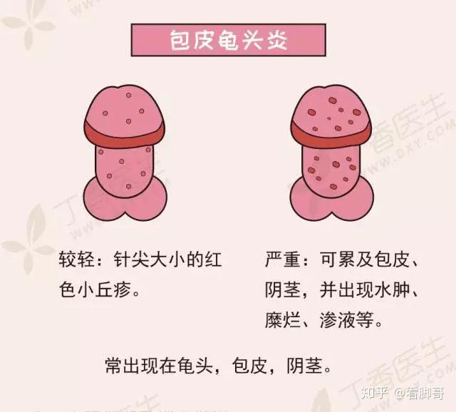 v2-51c6373bd5dcc5f178dc1f4a880dd76d_r.jpg