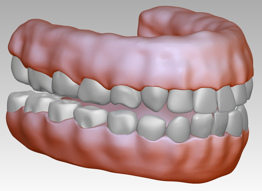 牙齿牙龈3D图下载，3D口腔模型下载，逼真高清牙龈模型图片素材- 知乎