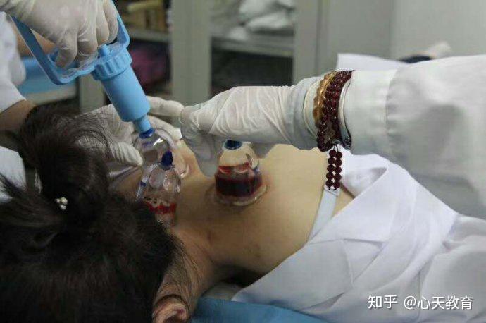 心天排瘀疗法高血压与颈椎病之间的小秘密