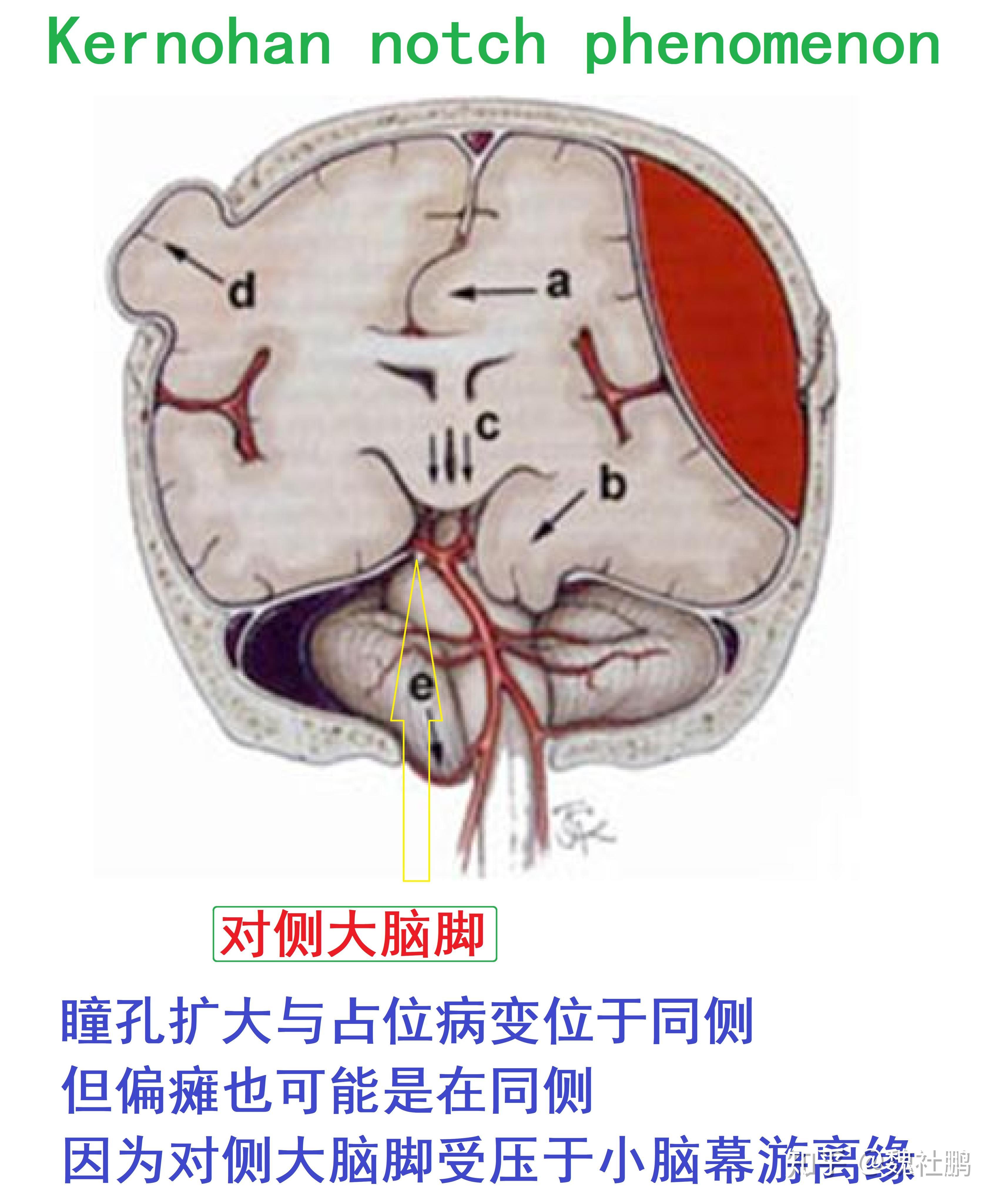 图5-3-7 视觉神经冲动传导通路-人体解剖学与组织生理病理学-医学