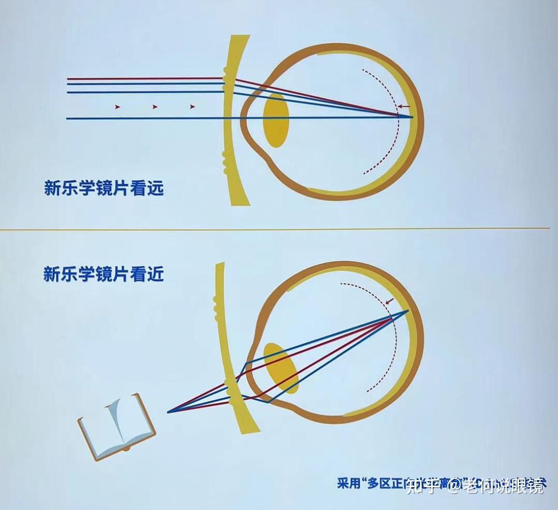 新乐学镜片原理图片