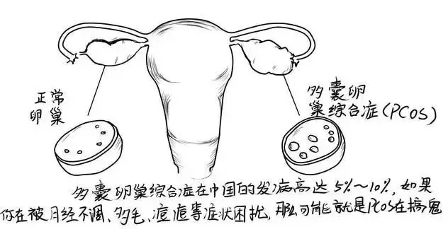 v2-521527a6ea5f6a2715d3b9a88261b7a5_1440w.jpg?source=172ae18b