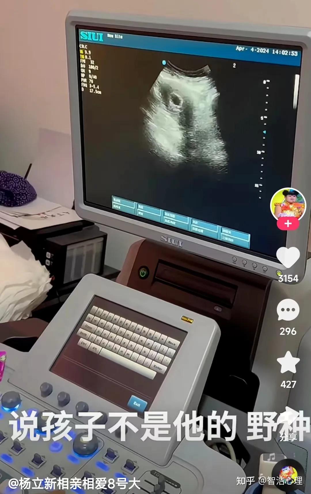 百万粉丝女网红被残忍杀害:从出轨,怀孕,堕胎,被杀