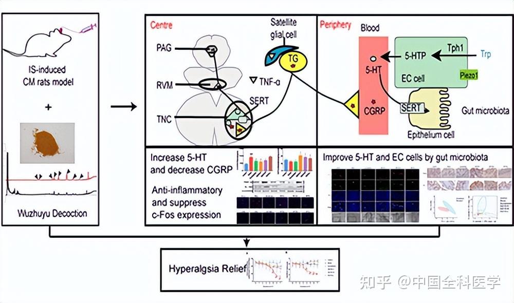 国自然资助成果我国学者发现中医经方改善慢性偏头痛的新机制