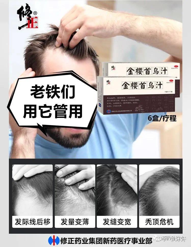 肝肾亏损请用修正牌金樱首乌汁明星产品金樱首乌汁