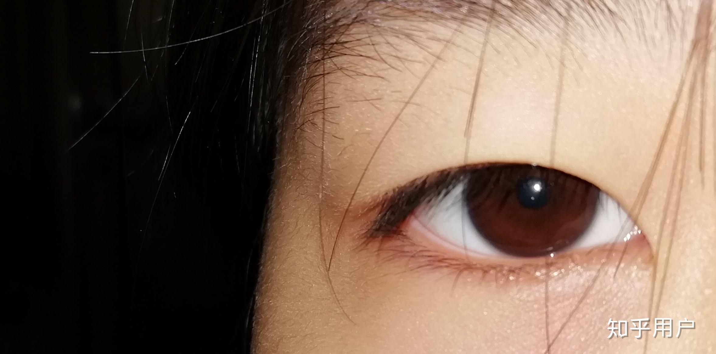 有一单一双的眼睛是啥样