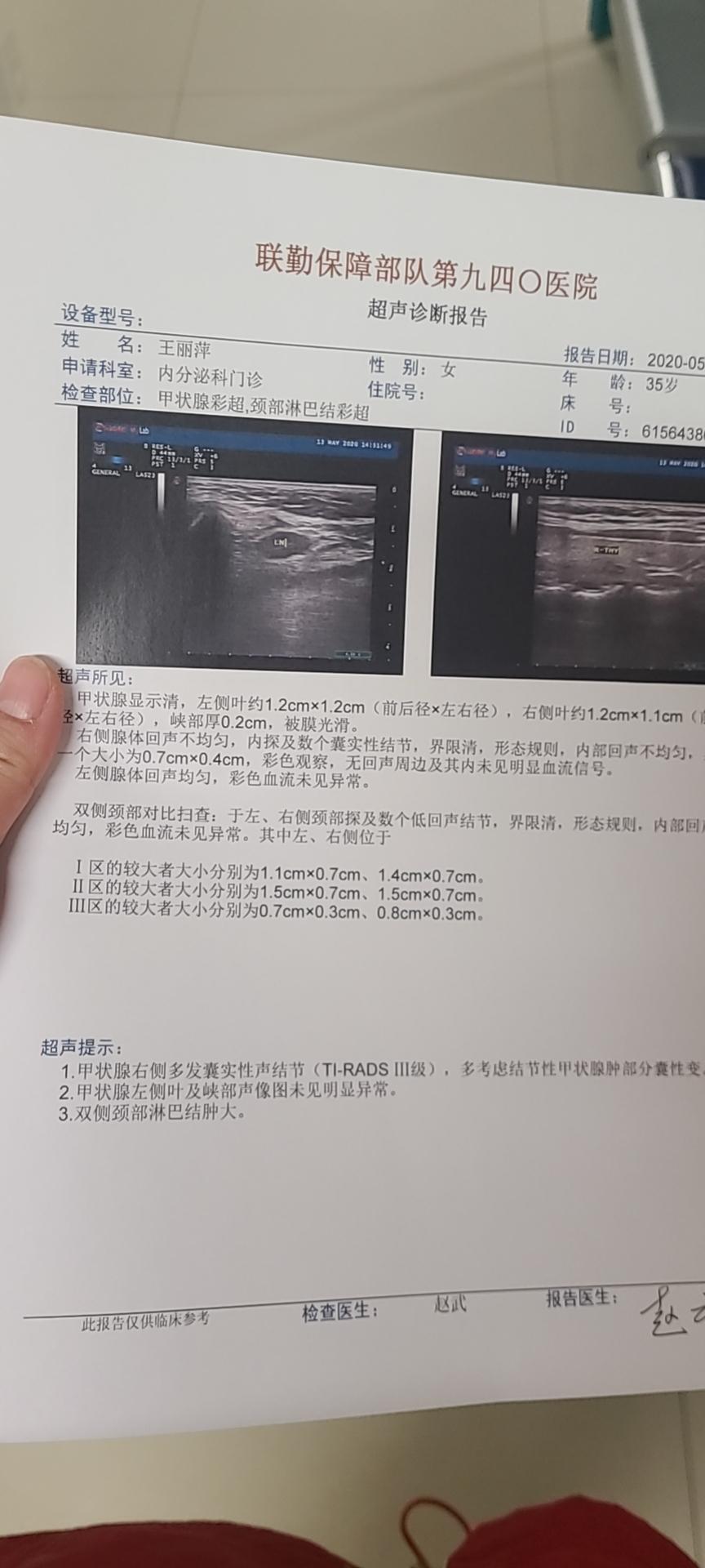 甲狀腺囊腫,甲狀腺結節,甲狀腺腫大三者區別,很多人傻傻分不清