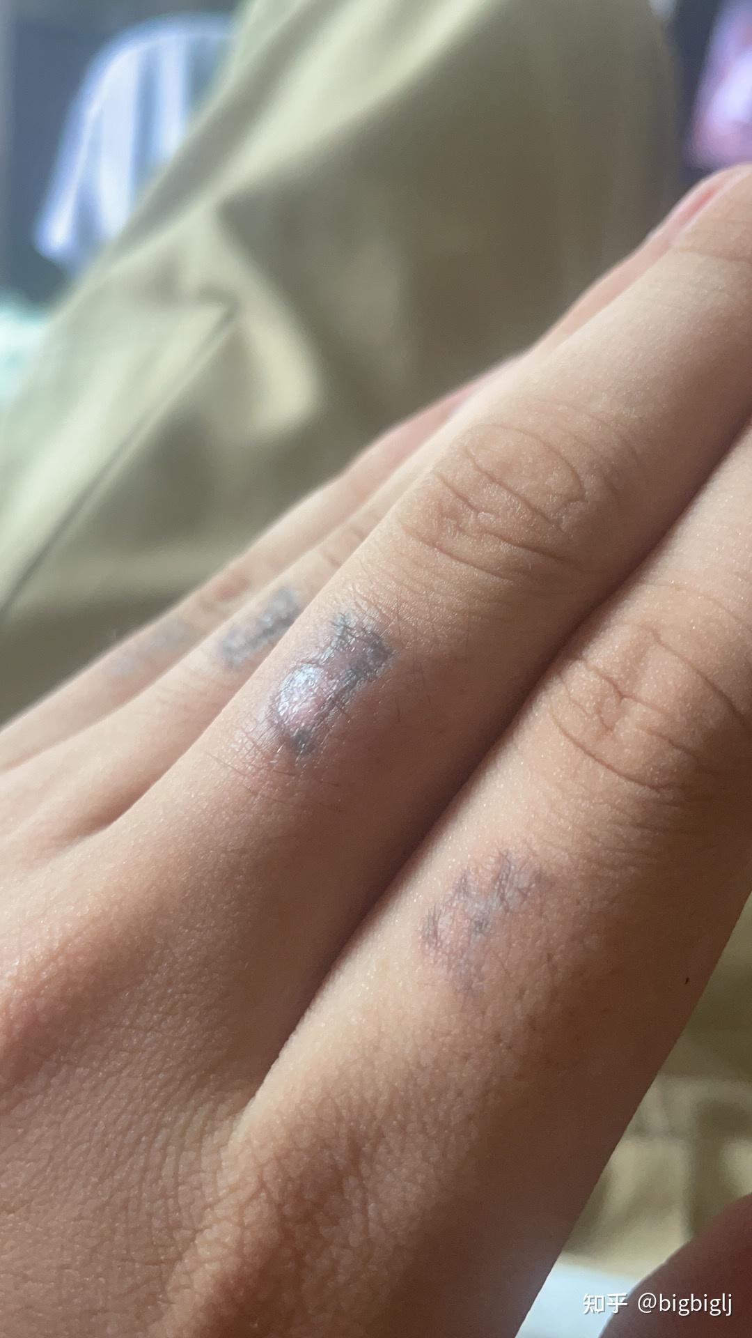 我洗纹身快一年了还没洗干净真的要分手吗? - 知乎