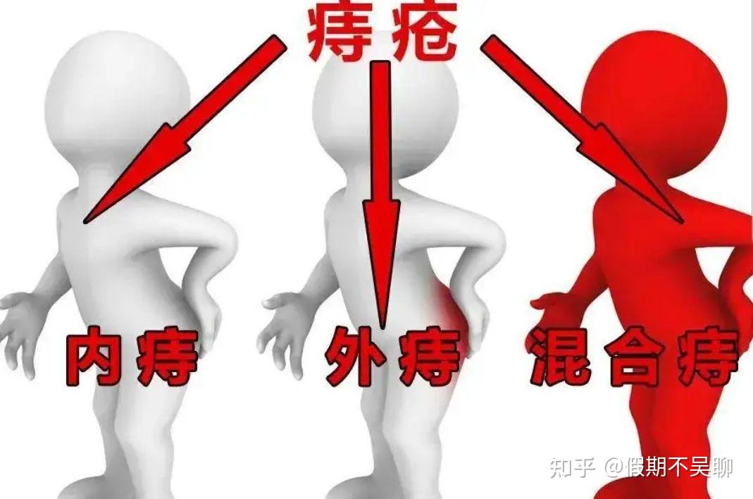 痔疮手术是不是一定很痛?