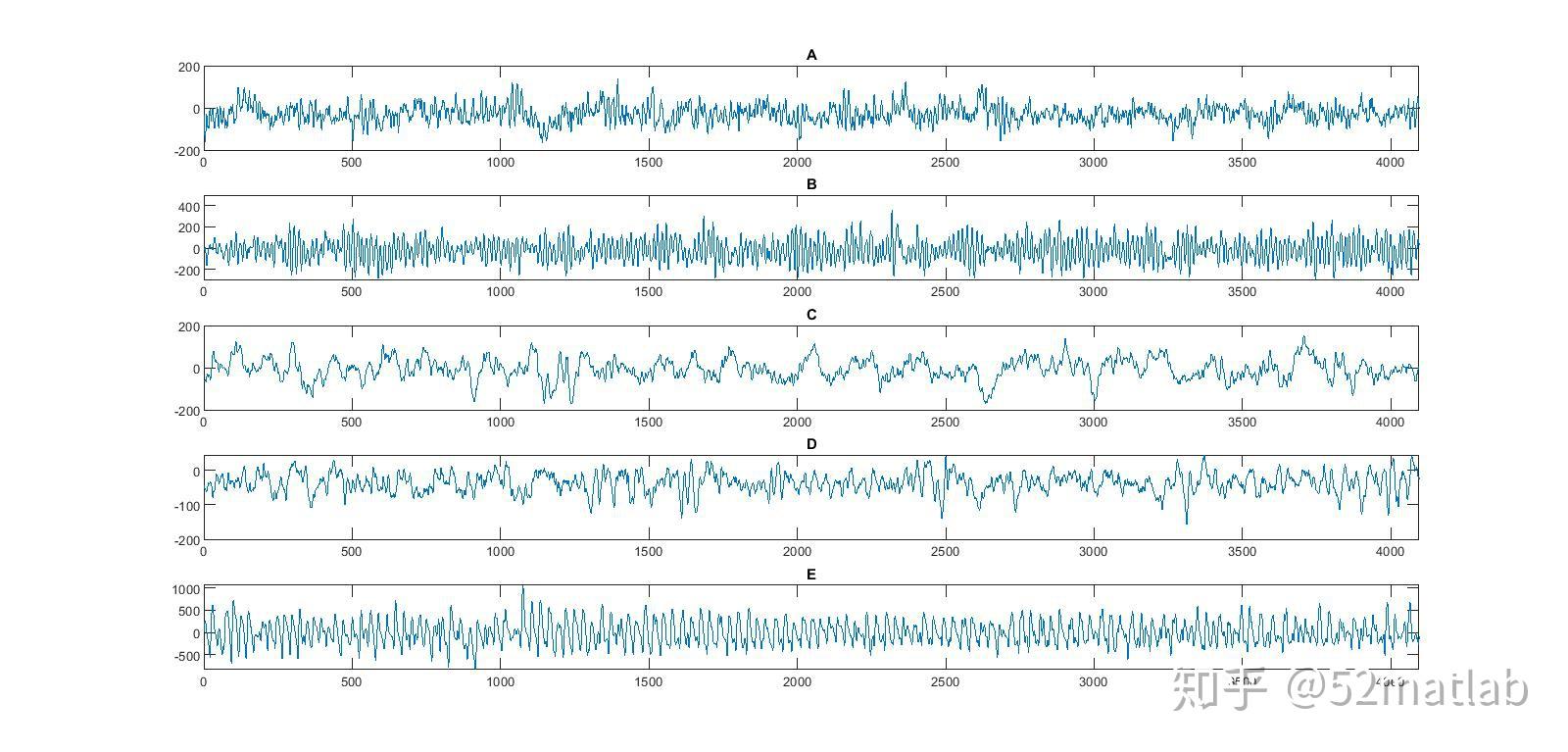 基于变异性脑电信号的分类方法